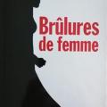 Brûlures de femmes